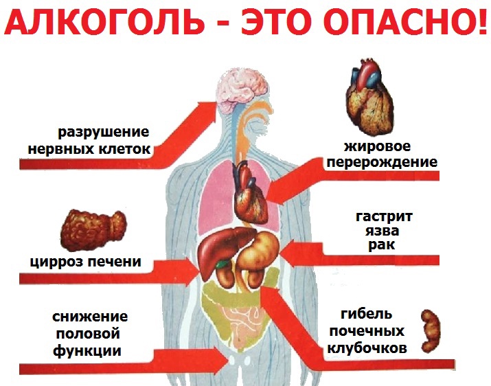 АЛКОГОЛИЗМ И ЕГО ПОСЛЕДСТВИЯ.